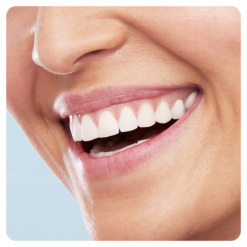 Oral-B Vitality 100 Sensitive UltraThin elektriline hambahari taimeri ja pehme harjapeaga (SININE) - Pilt 6